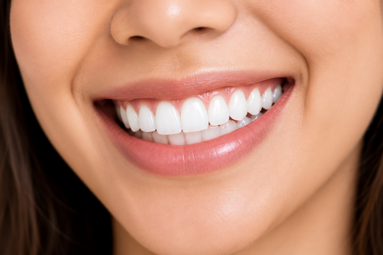 Close-up of a person's bright, white smile with even, healthy teeth.