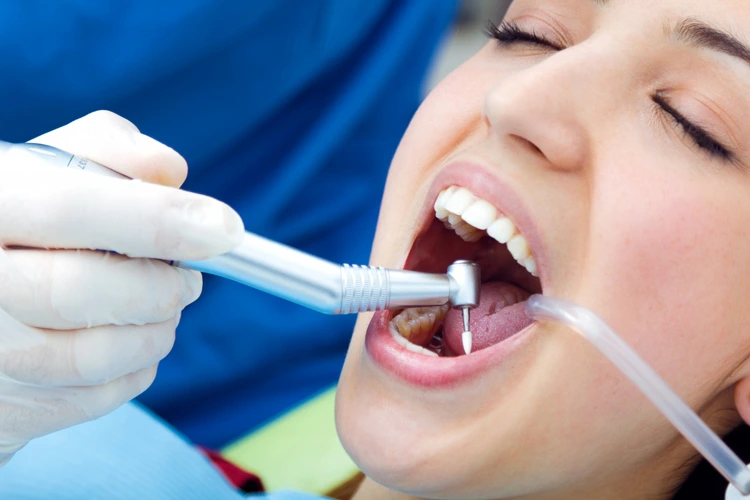 Female patient undergoing dental filling procedure.