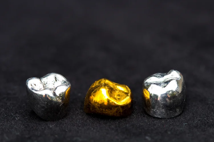 Gold and metal dental crowns displayed on black background to show different types of crown material.