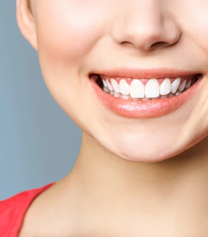 True Dental Studio offers Teeth Whitening services.
