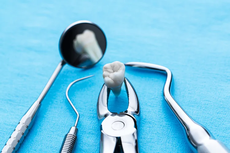 Removed wisdom tooth in dental forceps with dental tools on blue background used in extraction.