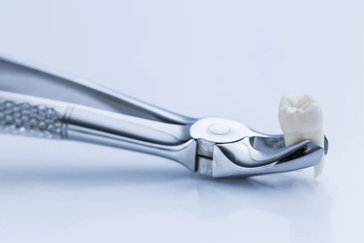Dental extraction forceps holding extracted wisdom tooth on white background after oral surgery.